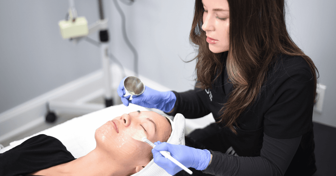 Anti-Aging Chemical Peels