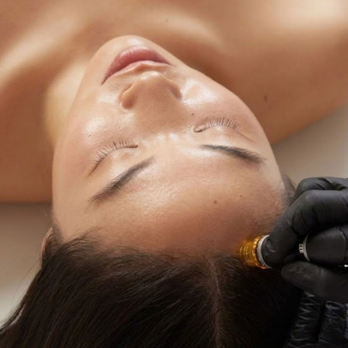 Hydrafacial-Keravive