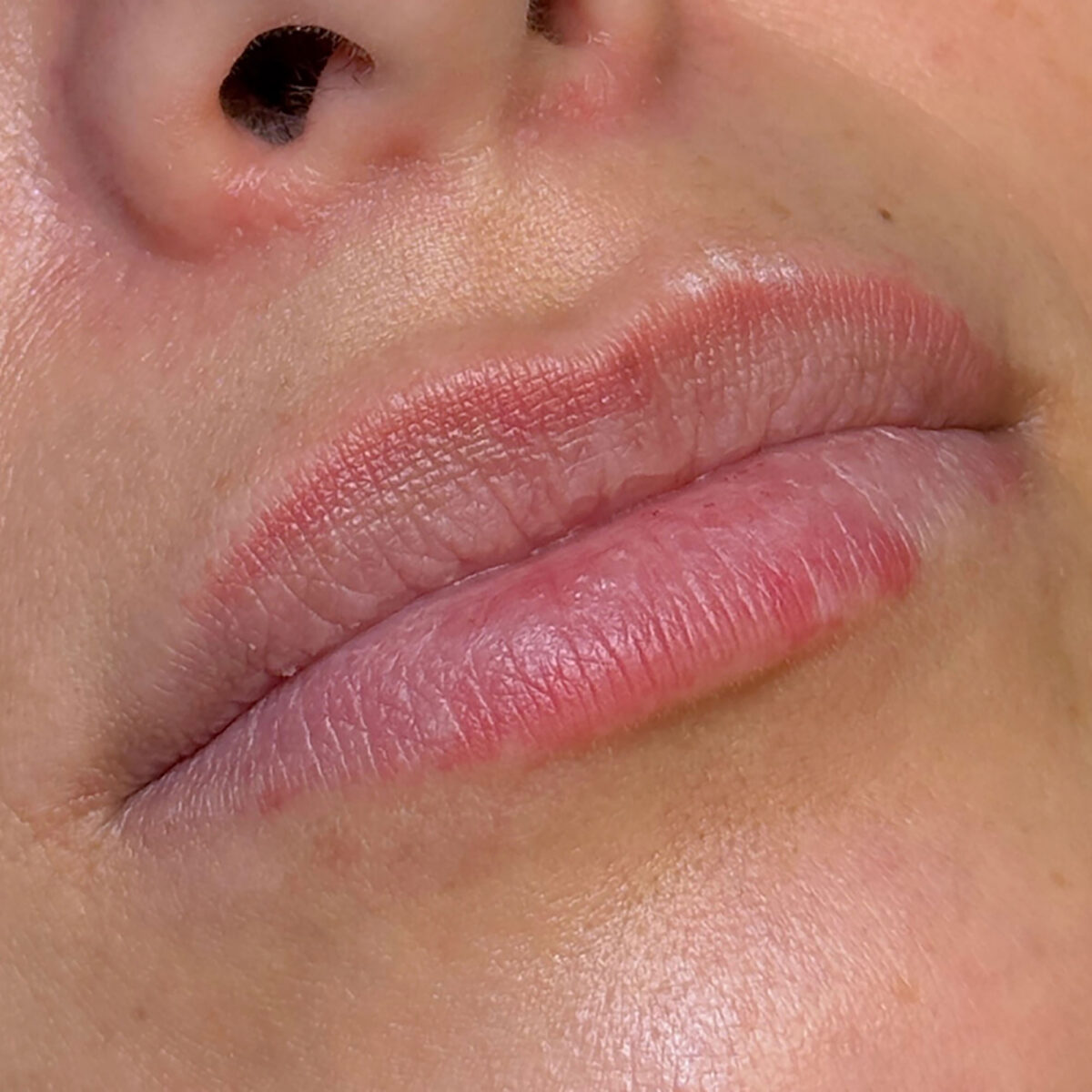 Before Image