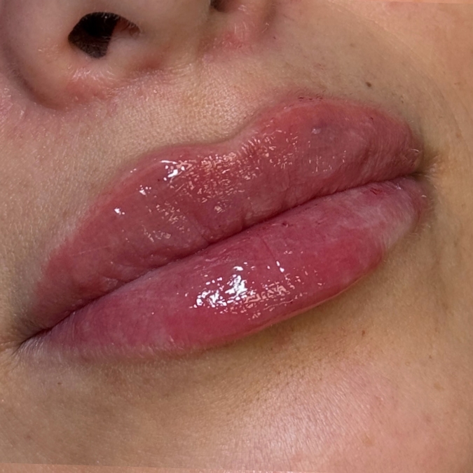 After Image