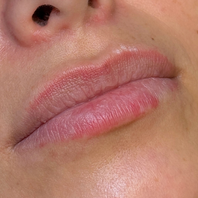 Before Image