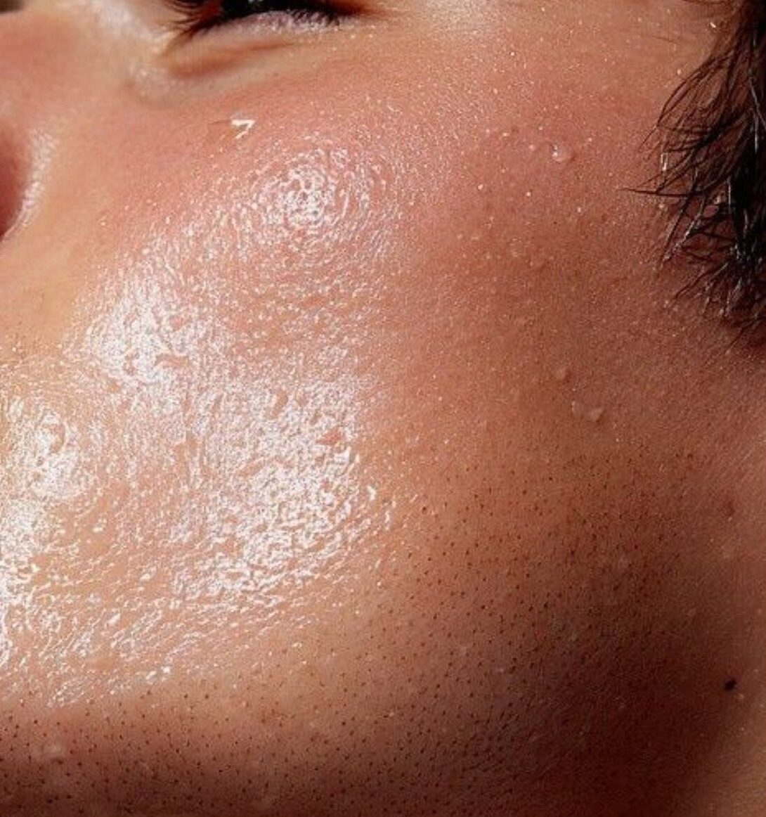 Woman's cheek
