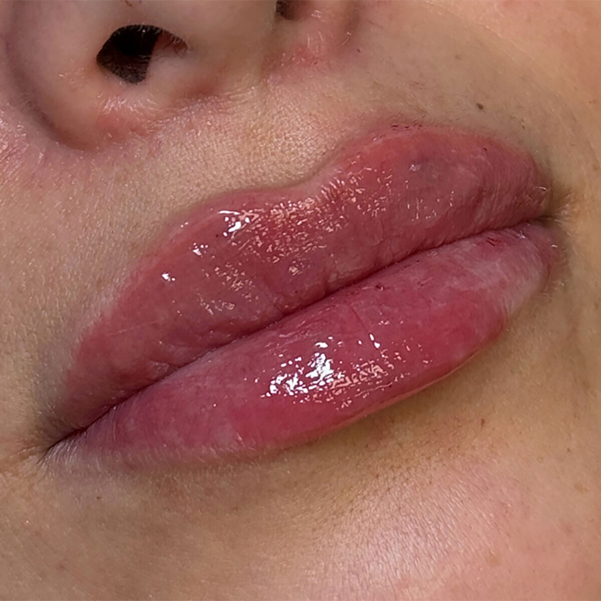 After Image