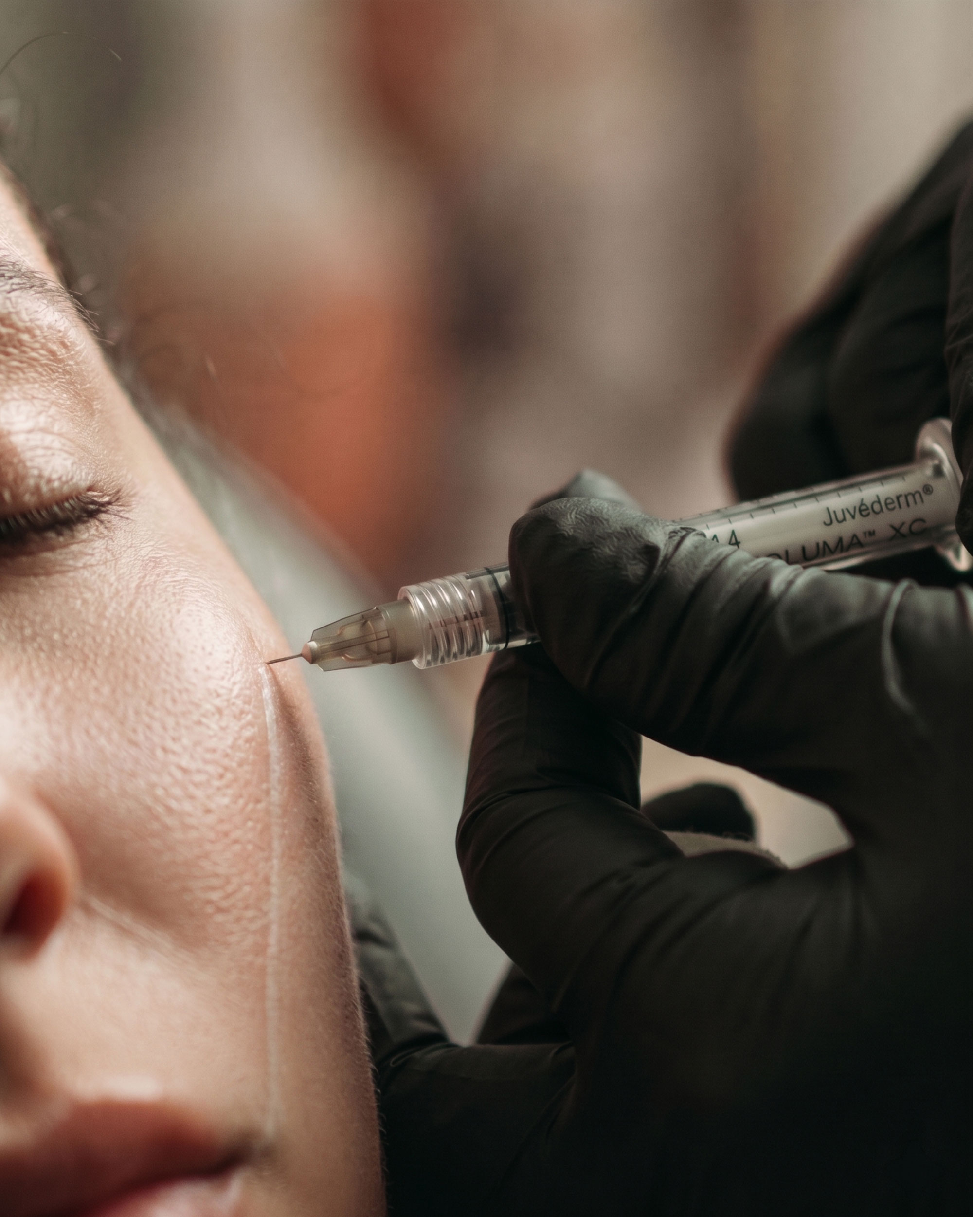 Juvederm-Portrait