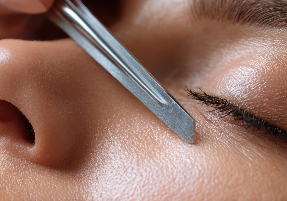 Woman receiving dermaplaning