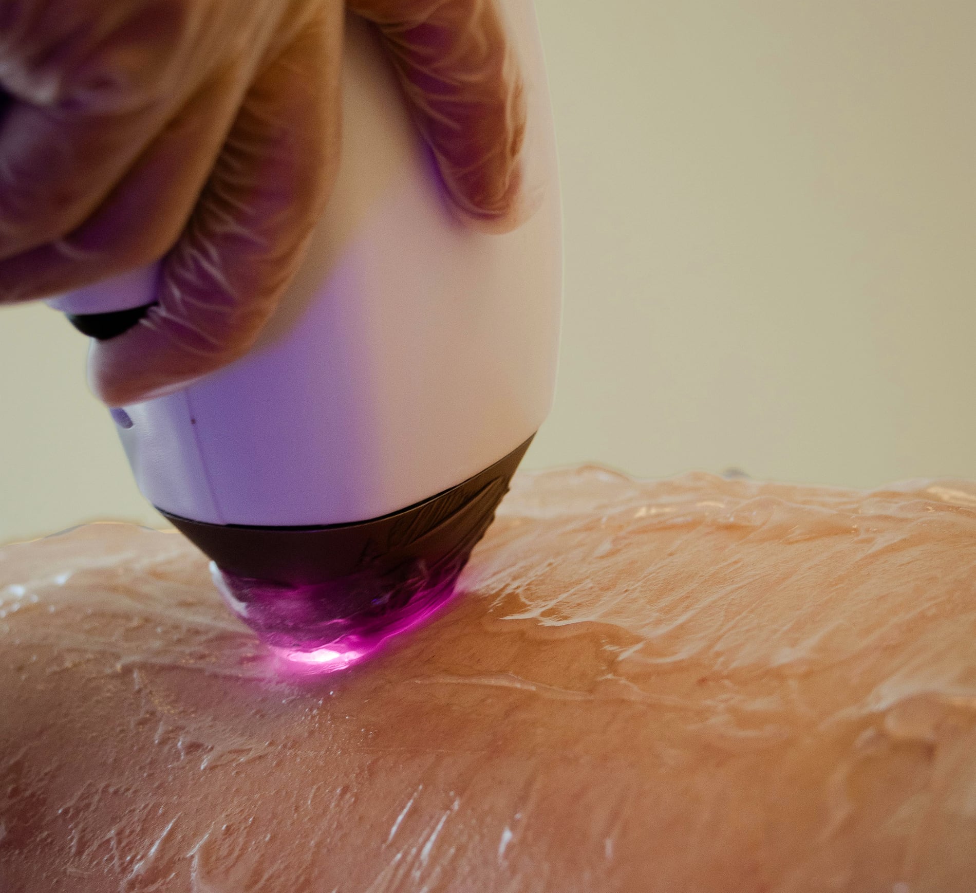 Laser wand