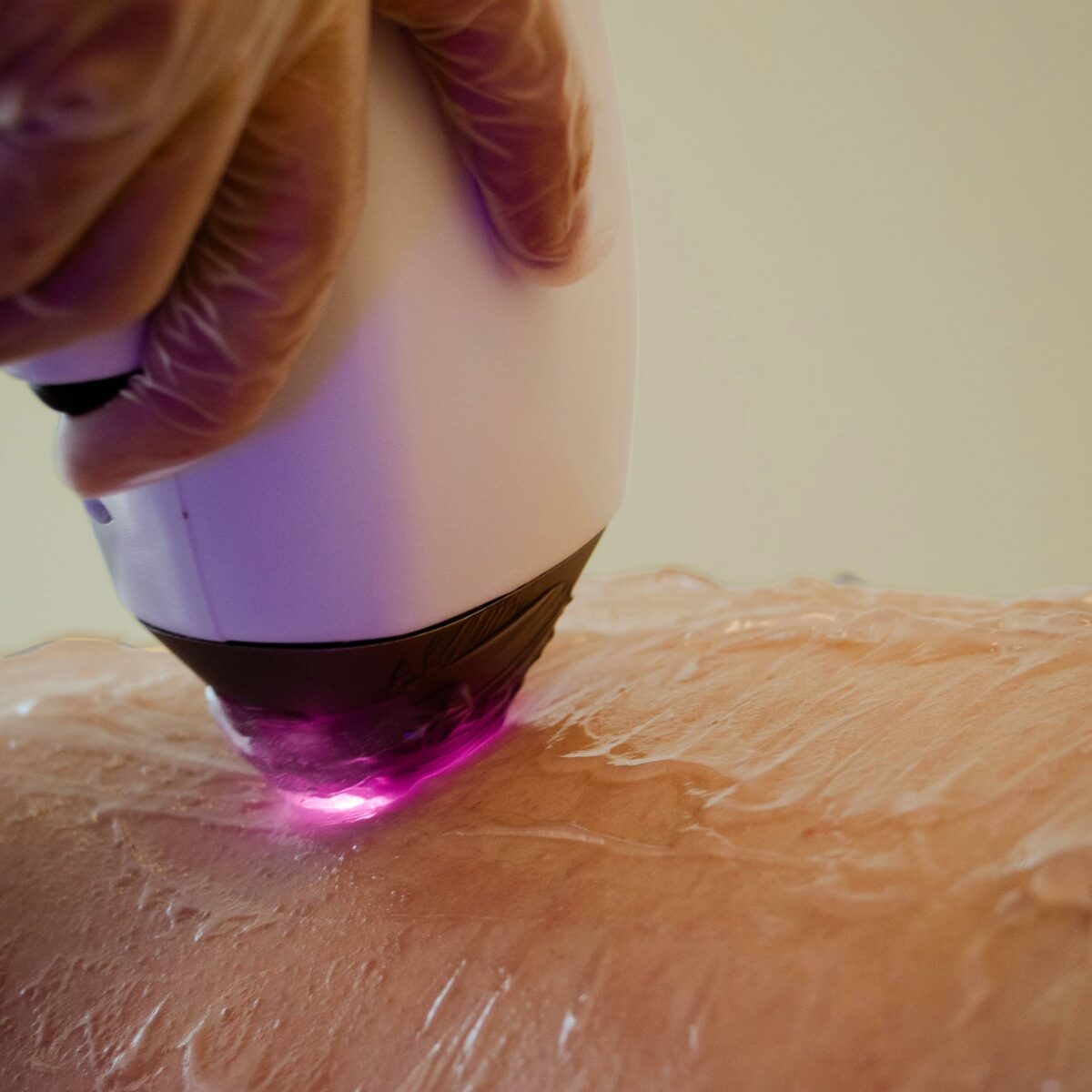 Laser wand