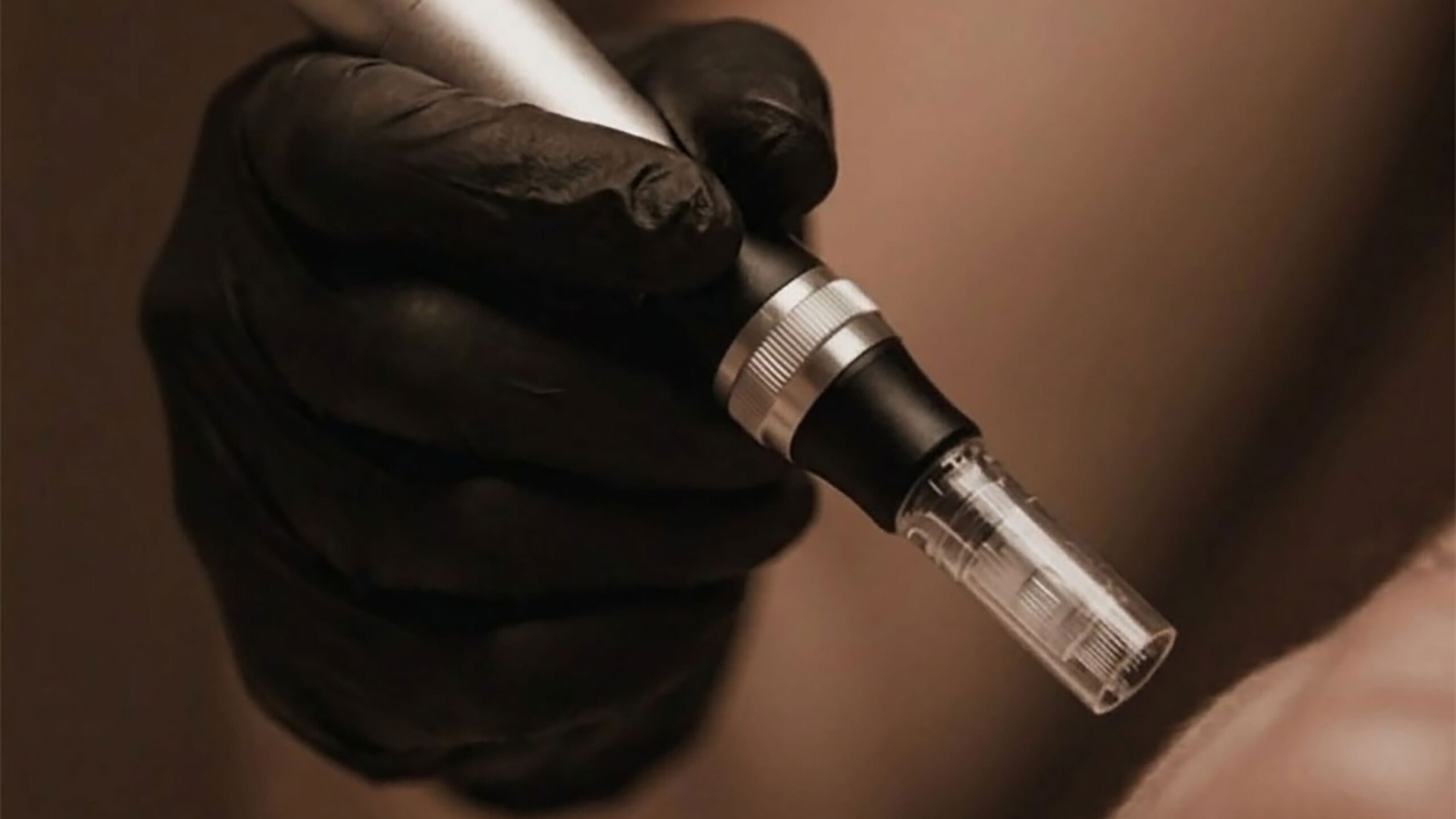 Microneedling