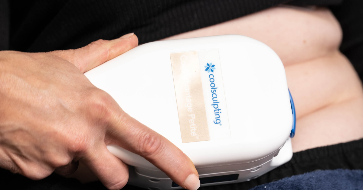 Coolsculpting Wand